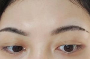 霧眉結痂尷尬期
