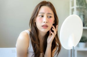 曬紅