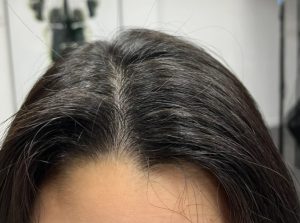縮毛矯正缺點
