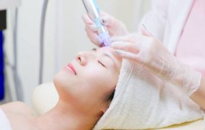 電動微針療程