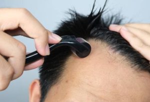 微針滾輪生髮