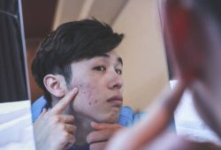 暗瘡印