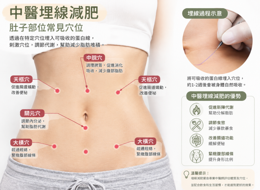 中醫埋線減肥